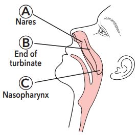 What is a Nasopharyngeal Swab?